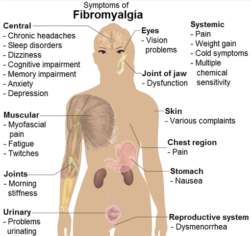 fibromyalgia_symptoms
